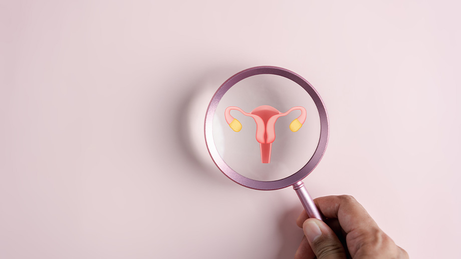 What Is PCOS?